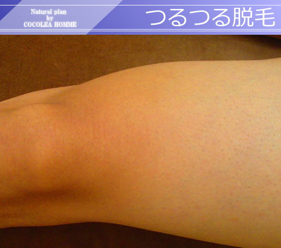つるつる脱毛2